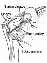 Biceps Pulley. Image via The Shoulder Doc.