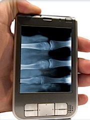 I want one of these. The portable X-ray machine, that is.